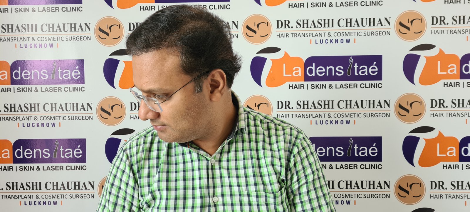 Rahul Agrawal After Hair Transplant